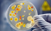 petri dish with hand