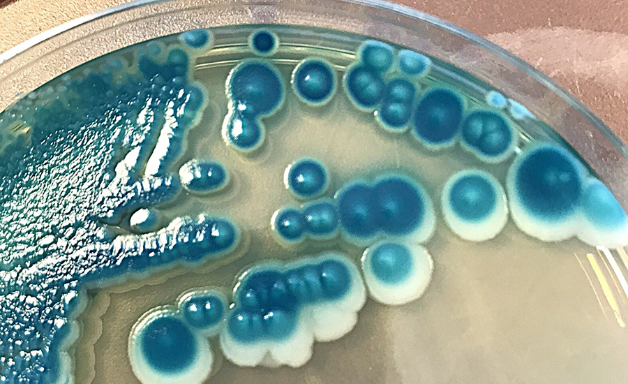 Bacillus cereus grown on agar plate