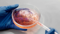 blue-gloved hands using pipette and petri dish with bacteria