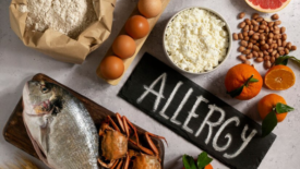 table with array of major food allergens and plaque that says allergy