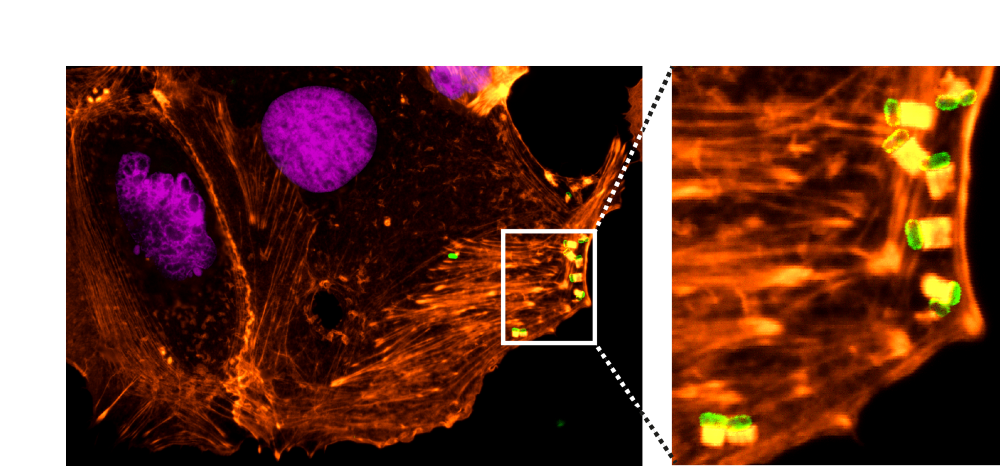 EHEC bacteria (green)